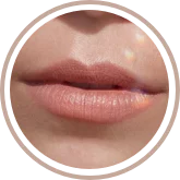 eliminar micropigmentacion de labios