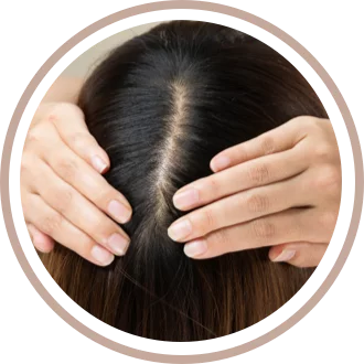 micropigmentacion capilar eliminacion